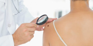 ogni quanto vanno controllati i nei